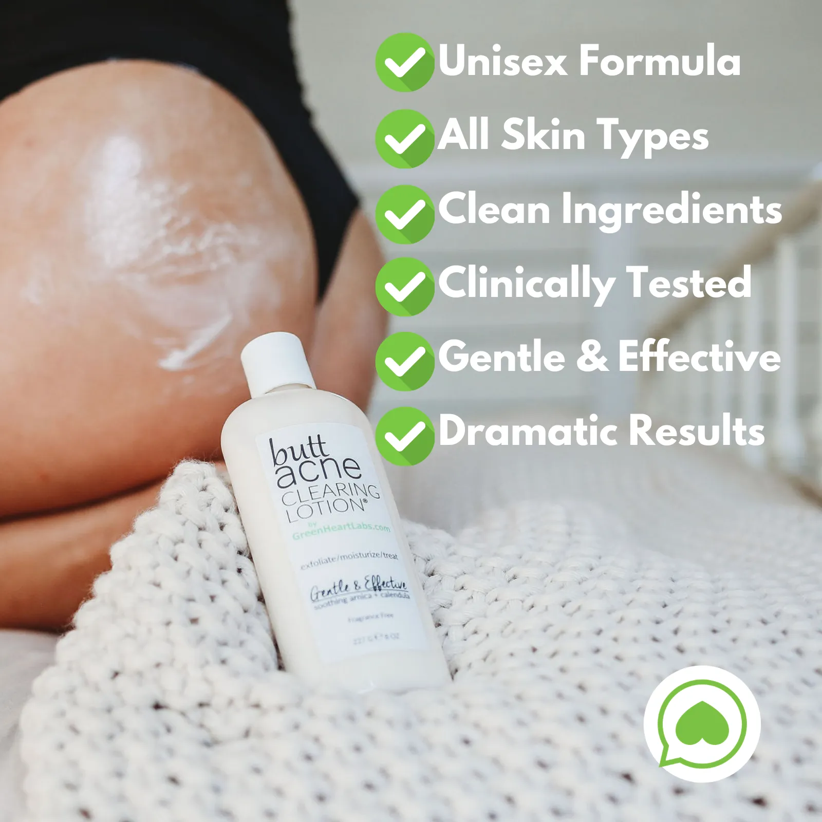 Butt Acne Clearing Lotion ® | 2-pack of (4oz, 113gr Each Bottle | = 8 oz, 226 gr Total)