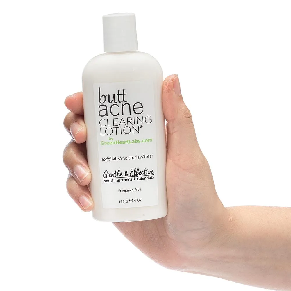 Butt Acne Clearing Lotion ® | 4 oz (113 gr)